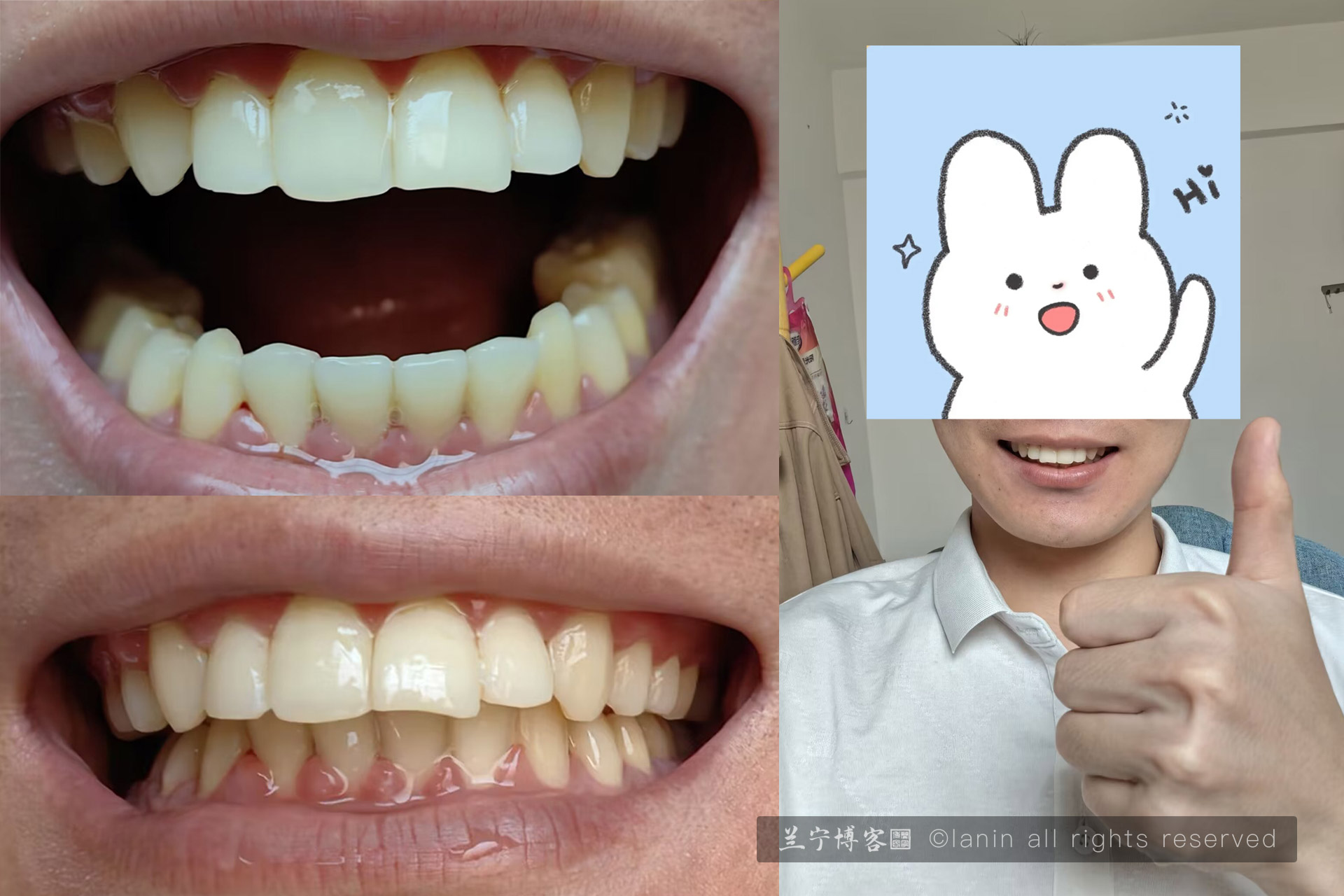 图片[1]-有辛酸有煎熬回头看看其实不算什么；人生很短，想明白自己要什么就朝着这个方向不断努力奋斗吧！-趣玩吧-LANIN·BK 兰宁博客